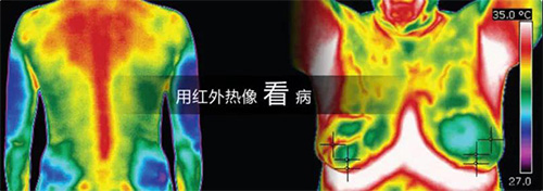 紅外熱像儀應用領域